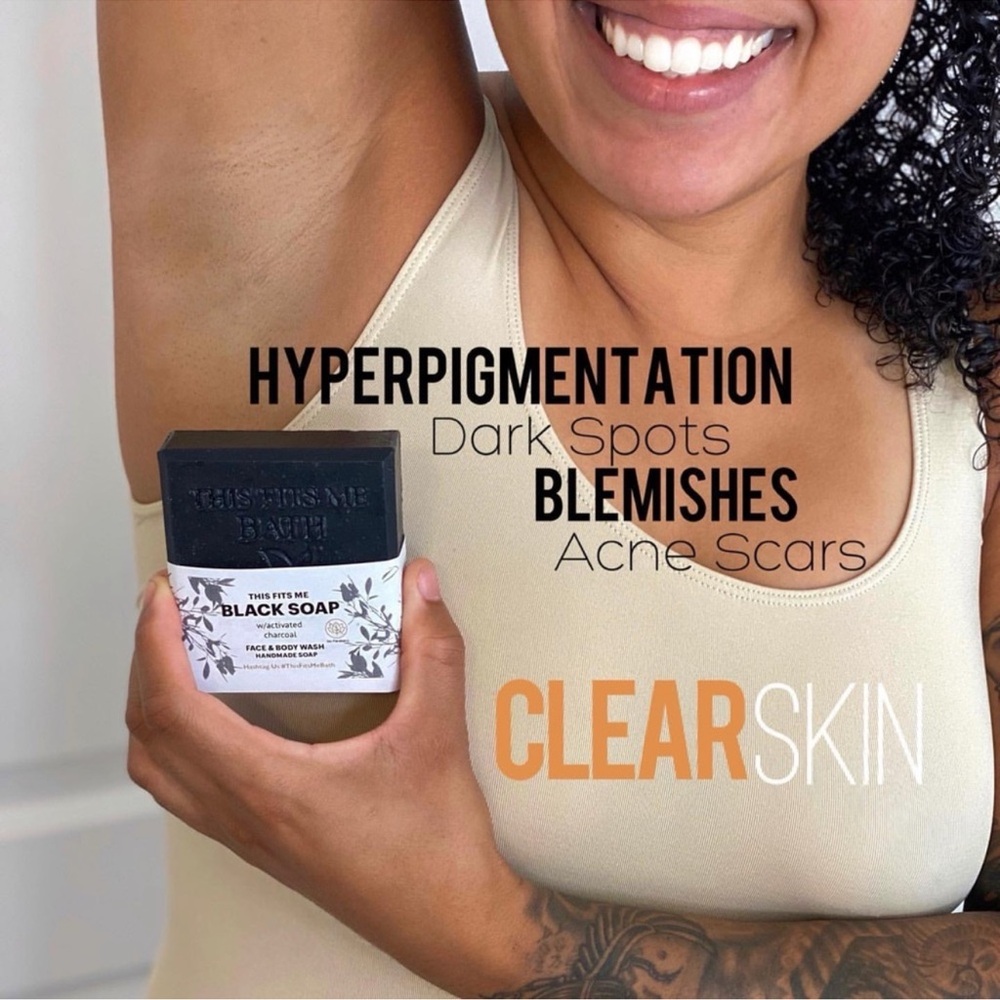 NWT Activated charcoal clean ingredients handmade soap hyperpigmentation - Picture 3 of 3